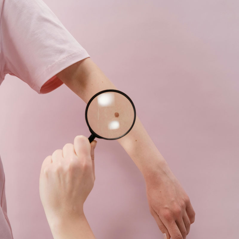 DermNet A global clinical resource site for dermatology and dermatologic conditions.